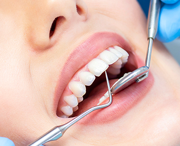 أهمية تنظيف الأسنان ودور الابتسامة الصحية في جمالك