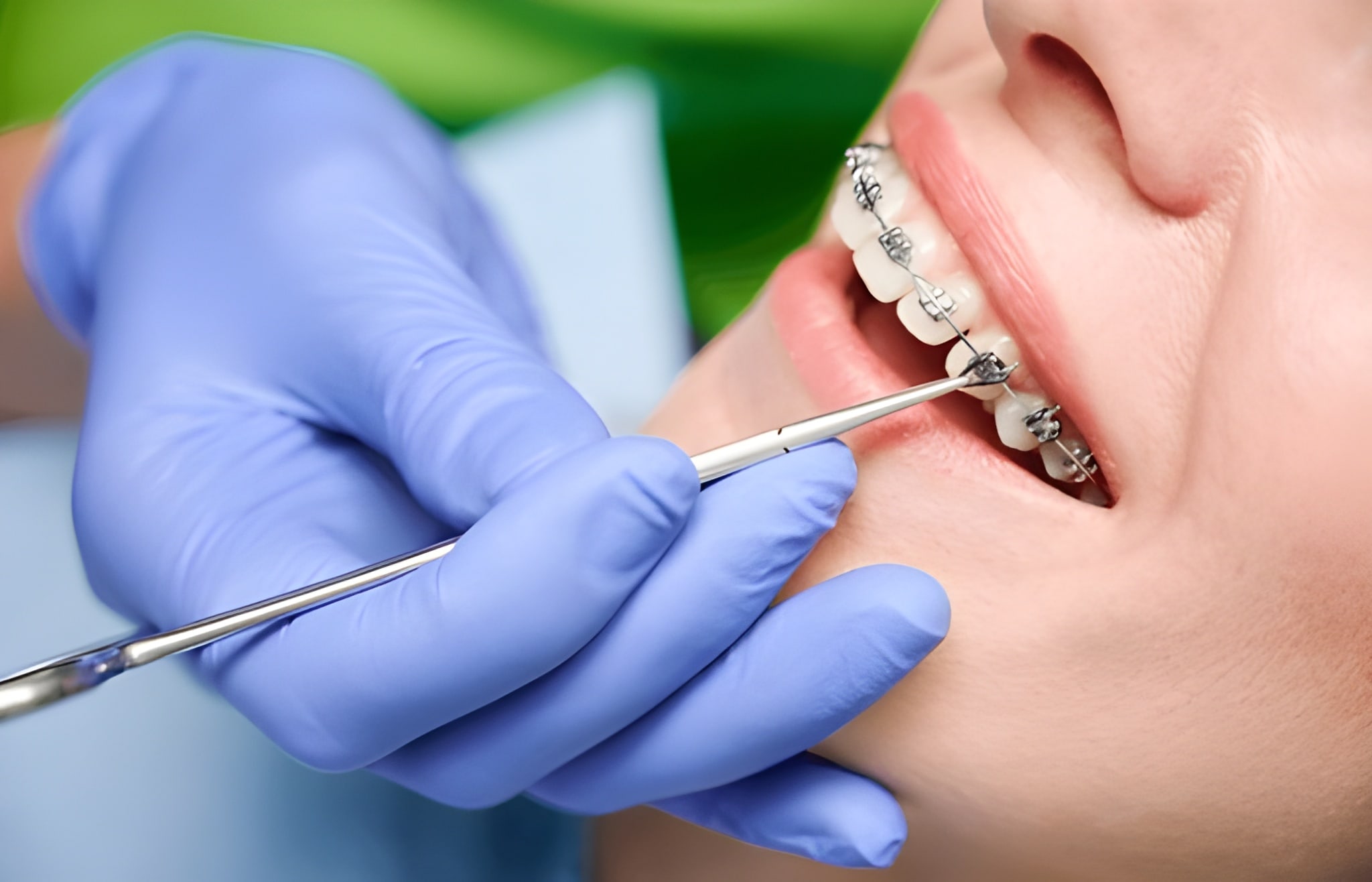 تقويم الأسنان